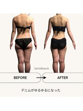 サンテボーテ(Sante Beaute)/筋膜リリース