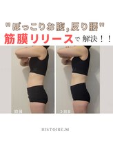 イストアールエム(HISTOIRE.M)/筋膜リリースダイエットコース