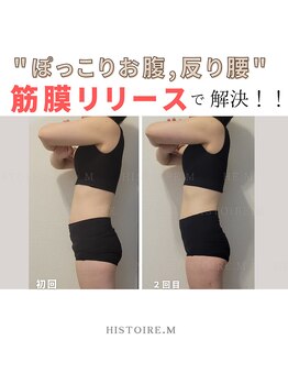 イストアールエム(HISTOIRE.M)/筋膜リリースダイエットコース