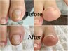 【New!】巻き爪緩和ケア（自然なマット仕上げ）※メニュー追加でジェルもOK