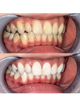 ライトビューティー 池袋店(LightBeauty)/症例写真