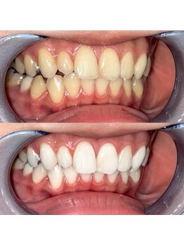 ライトビューティー 池袋店(LightBeauty)/症例写真