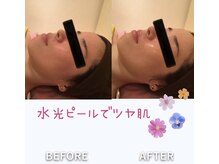 ビューティースパ/水光肌/ツヤ肌になりたい方必見!