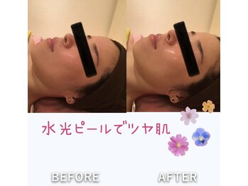 ビューティースパ/水光肌/ツヤ肌になりたい方必見!