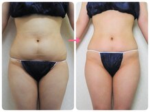 庭夢エステの雰囲気（体重―6kg。ウエスト―10cm達成！骨格スリムメソッド12回。）