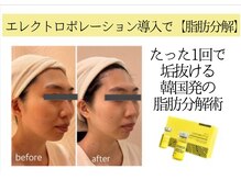 クリニカルエステ/イーズ 六甲アイランド店/20～30代　小顔むくみ