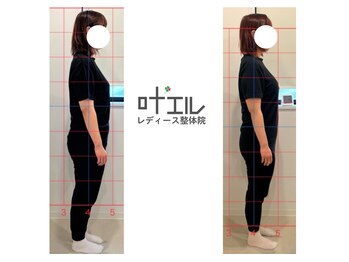 叶'エル 本町 心斎橋院/姿勢改善　骨盤矯正