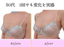 ビーハピネス 京都西院(B-Happiness)/１回で驚きの変化！