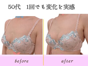 ビーハピネス 京都西院(B-Happiness)/１回で驚きの変化！