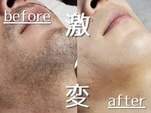 ラピスダズル(LAPIS DAZZLE)の雰囲気(ムダなく1回ごと確実に効果を出す!結果重視メンズ脱毛専門店!)