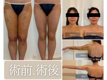 リセ(RESE)の雰囲気（術前～術後ケア、お任せください！）