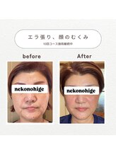 ねこのひげ/お客さんの経過！