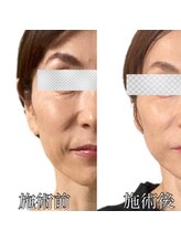 エリクシア 松戸/リンパ小顔矯正