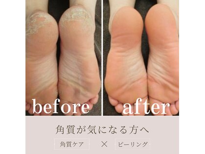 ロコ(ROCO)の写真