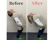 整体ラルース 中目黒(LALUZ)/20代　女性　腰痛、反り腰改善