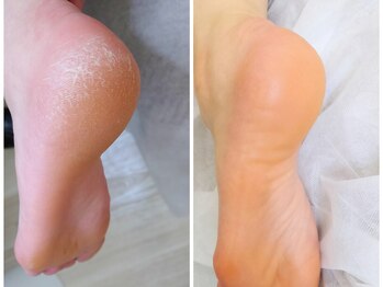 リゼラアンドコー 浦安店/ドイツ式フットケア専門店