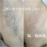 ソワン(soin)