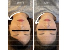 ヴィシャイン(vi shine)/輪郭美人になるには？