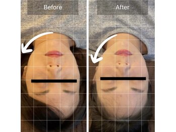 ヴィシャイン(vi shine)/輪郭美人になるには？