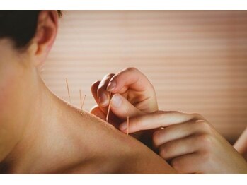 どんぐり鍼灸院 接骨院/ 【鍼灸施術】