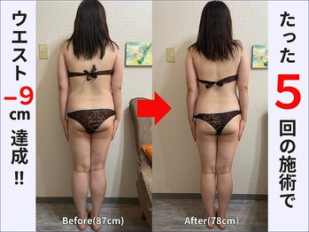 ぷりんす整体コージー(COZY)/【20代 女性】ビフォーアフター