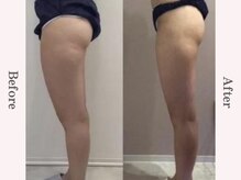 ビューティースタジオ エイワン(A1)/