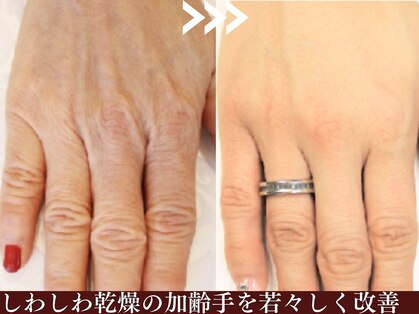 大人ネイルの写真