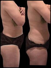 マハロ スコータイ/ビフォーアフター　＜腰＞