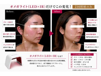 ノエル(Noel)/ 肌の土台から整えるLED美容