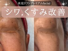 ミトラ(MITRA)の雰囲気(シワ/たるみ改善!水光美肌♪フォトギャラリーでもご紹介してます)