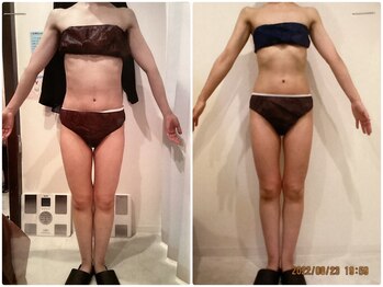 パーフェクトボディプレミアム 大阪梅田店(PERFECT BODY PREMIUM)/お客様 ビフォーアフター(20)