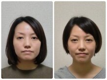 フィシス/エラの張りが気になる方向け