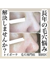 トイボーテ(toi beaute)/毛穴の事はお任せ下さい！