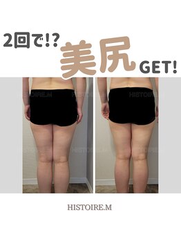 イストアールエム(HISTOIRE.M)/筋膜リリースダイエットコース