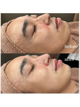 ルミナス(Luminous)/ララピール