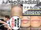 レイ(R.E.I)の写真