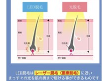 効果に驚き！LED脱毛は光脱毛の半分の回数で完了！