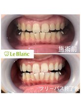 ルブラン 奈良店(Le Blanc)/