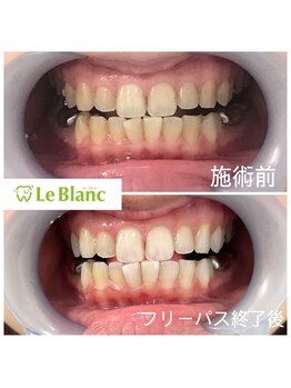 ルブラン 奈良店(Le Blanc)/