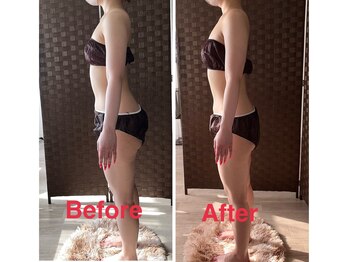 サントーシャ(Santosha)/でっ尻が解消!美尻に