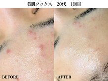 サンビ(SANBI)/顔の産毛見られているかも？