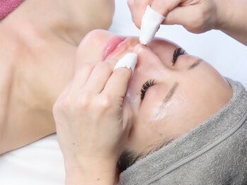 クロス(Xcross)の写真/毛穴の悩み解決へ!大人気・毛穴エクストラクション/毛穴の奥の黒ずみや角栓がごっそり取れる◎毛穴スッキリ