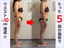 ぷりんす整体コージー(COZY)/【50代 女性】ビフォーアフター
