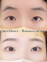 アイモア 江南店(eye mor.)/before after