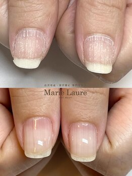 マリーロール 梅田店(Marie Laure)/自爪育成/深爪矯正/ネイルケア