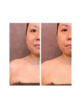 ラポール/リンパドレナージュ