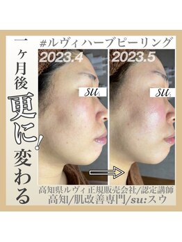 スー(su:)/痩せた！？と言われる方続出！