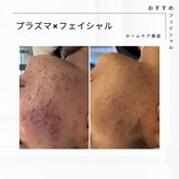 エム(M)