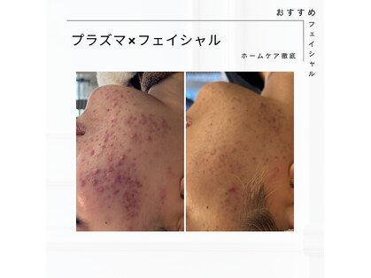 エム(M)の写真