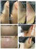 ★女性★人気のセット　フェイシャルWAX＋うなじWAX脱毛　10800円→10000円